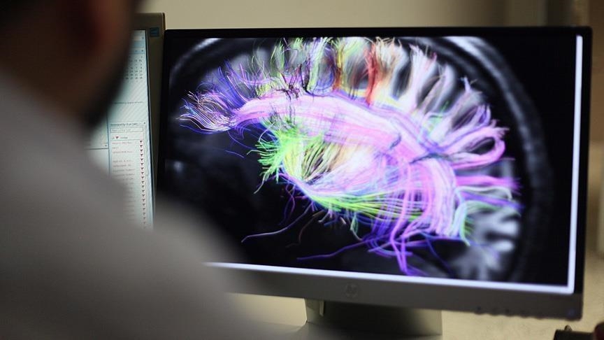 Studimi  Truri i njeriut nuk arrin pjekurinë deri në moshën 32 vjeçare