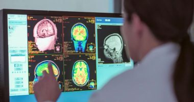 Studimi: Adoleshenca zgjat deri në të 30-at