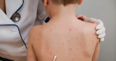 Fruthi, nuk ka raste të reja/ ISHP: Fëmija i shtruar në QSUT, rast i izoluar