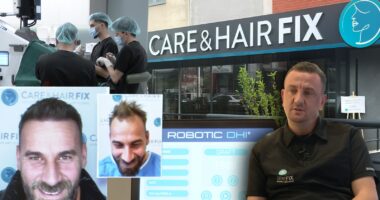 Histori suksesi/ Klinika e parë robotike për mbjelljen e flokëve në Shqiptari e Ballkan, risitë