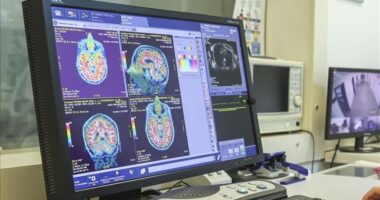 Norvegjia prezanton një test gjaku për të zbuluar ndryshimet në tru të lidhura me alzheimerin