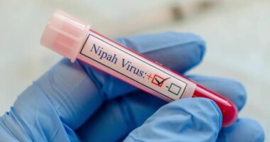 India lufton shpërthimin vdekjeprurës të virusit Nipah
