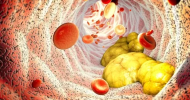 Hulumtimi: Kolesteroli i lartë shoqërohet me jetëgjatësi më të madhe