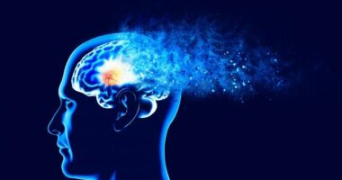 Inteligjenca Artificiale parashikon alzheimerin me një saktësi prej 93 për qind