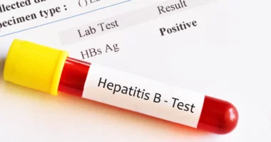 Hepatiti B, mbulesë e lartë vaksinale/ ISHP: Por ka ende frenim për vaksinën e fruthit, e morën 82%