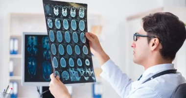 Shenjat e para të Alzhaimer mund të fillojnë që në moshën 30 vjeç, shkencëtarët zbulojnë rolin e “locus coeruleus”