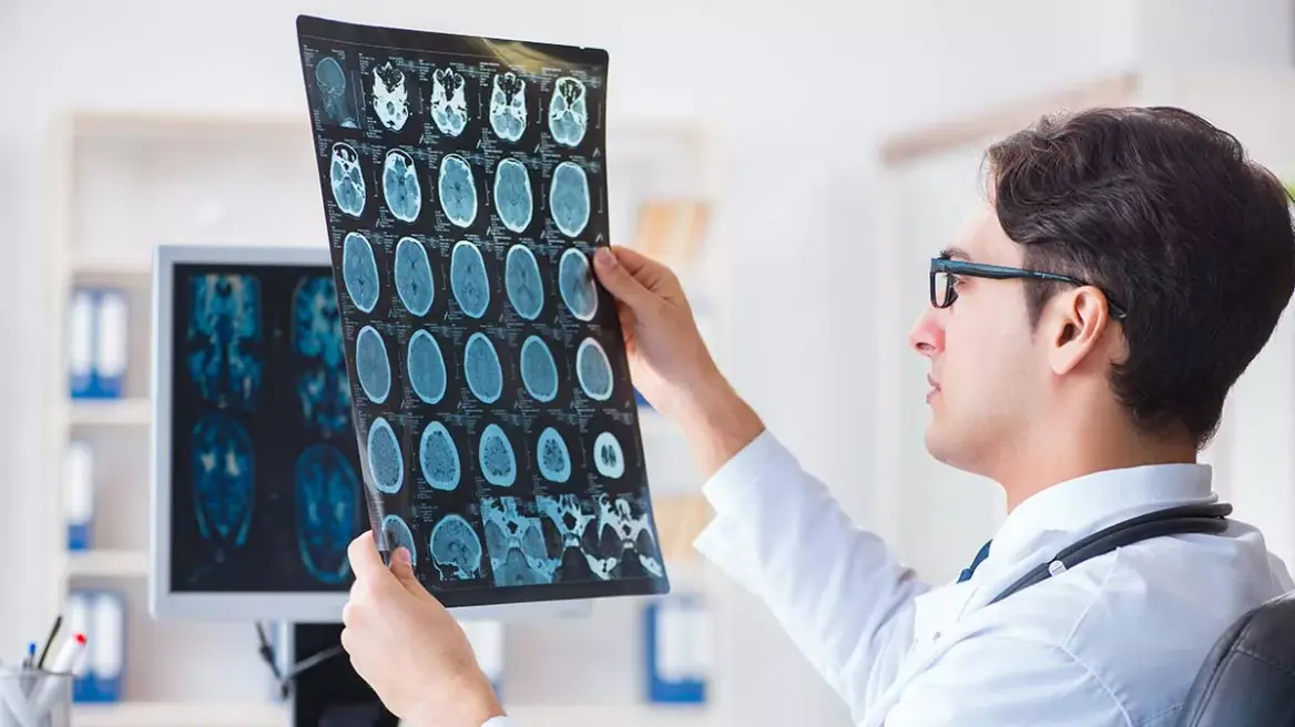 shenjat-e-para-te-alzhaimer-mund-te-fillojne-qe-ne-moshen-30-vjec-shkencetaret-zbulojne-rolin-e-locus-coeruleus