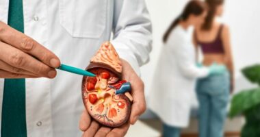 A shkaktohen gurët në veshka nga ushqimet? Ja çfarë thotë shkenca