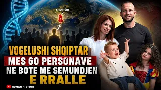 Djali i prekur me sindromën ultra të rrallë gjenetike, rrëfimi prekës i nënës heroinë të Dardit