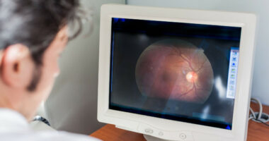Sytë mund të zbulojnë rrezikun e Alzheimer/ Studimi: Retina si “pasqyrë” e shëndetit të trurit