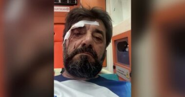 Dhunohet Ilir Demalia/ Sulmohet fizikisht nga fqinji, shpallet në kërkim autori
