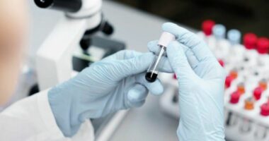 Teste droge për zyrtarët francezë