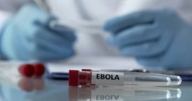 Rritet numri i rasteve me Ebola në Kongo, shkon në mbi 1 mijë numri i të prekurve