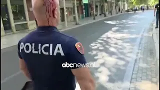 Protestuesit, gurë policisë/ 6 efektivë marrin ndihmë mjekësore në spital