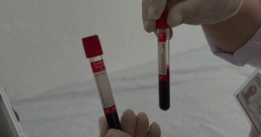 Rasti i parë me Ethet e Nilit në Shqipëri/ ISHP nis hetimin epidemiologjik në Korçë
