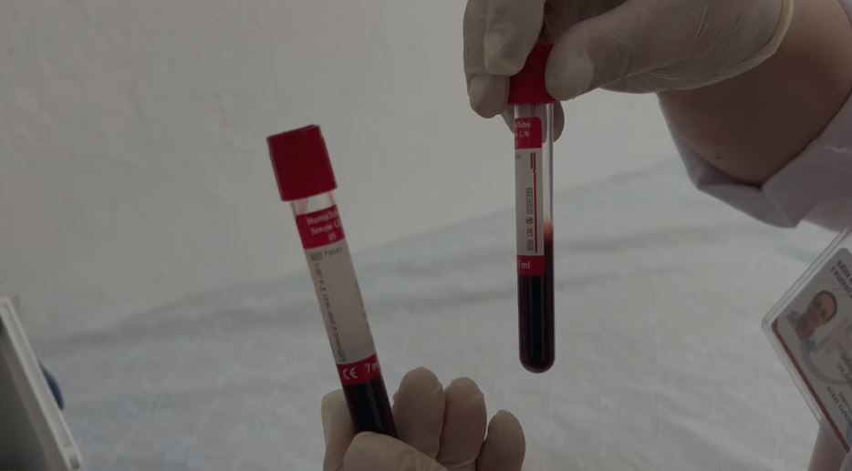 Rasti i parë me Ethet e Nilit në Shqipëri/ ISHP nis hetimin epidemiologjik në Korçë