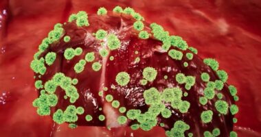 Shqipëria miraton për herë të parë Planin Kombëtar për Eliminimin e Hepatiteve Virale