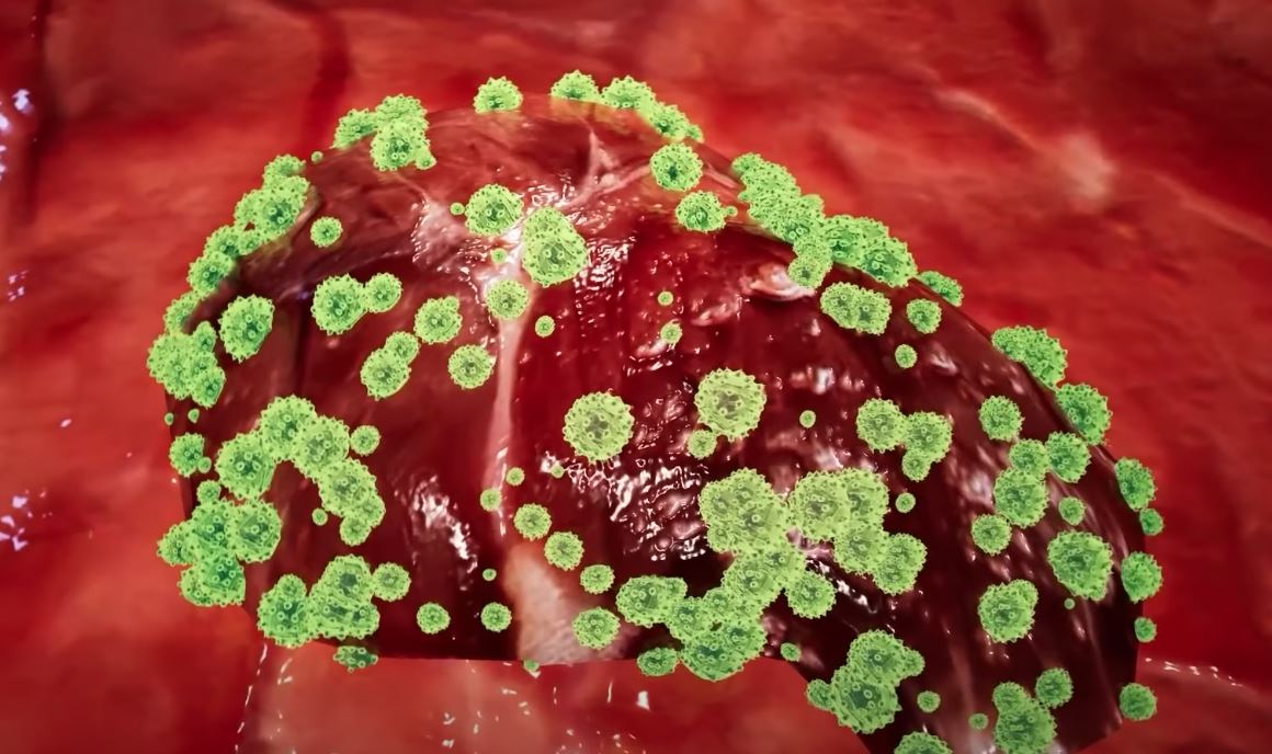 Shqipëria miraton për herë të parë Planin Kombëtar për Eliminimin e Hepatiteve Virale