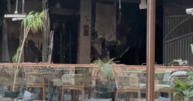 Mbeti e plagosur rëndë pas zjarrit që përfshiu hotelin në Vlorë, 25-vjeçarja pritet të dërgohet për mjekim në Turqi
