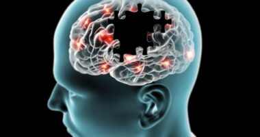 Pse terapia nuk funksionon njësoj për të gjithë pacientët me Parkinson?